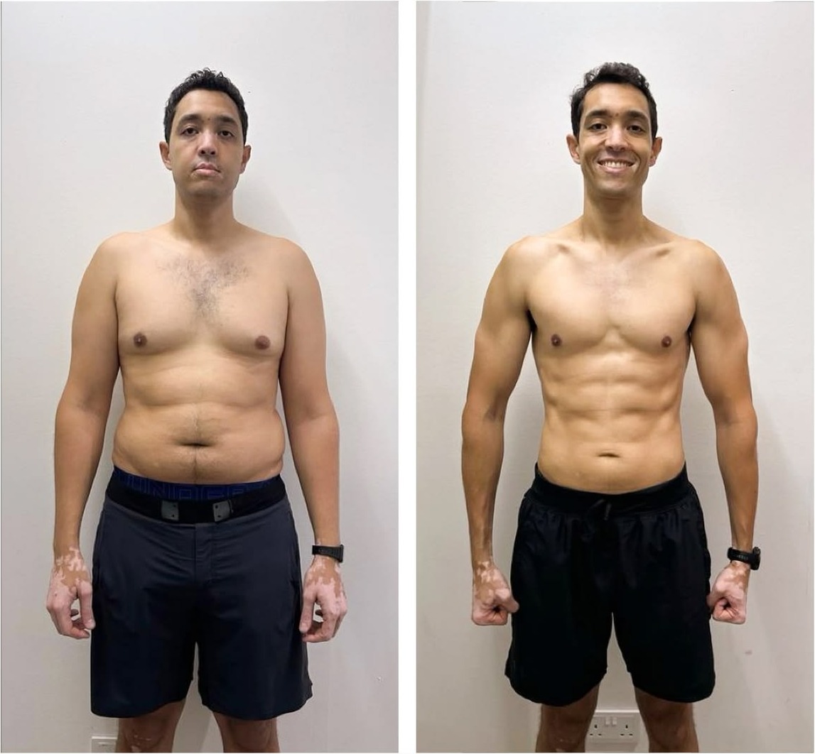 Comparação antes e depois de Rogério, 32 anos