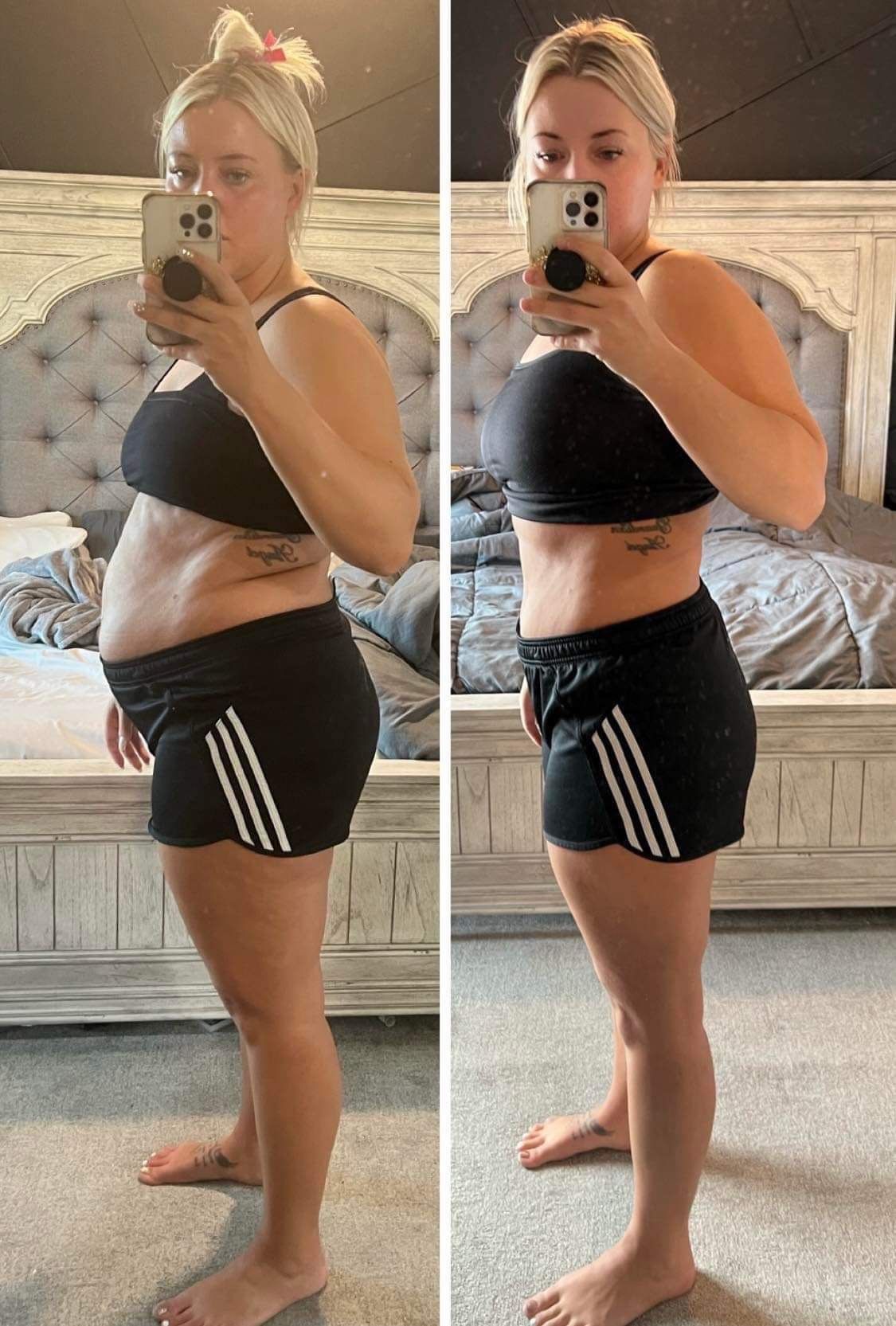 Comparação antes e depois de Camila, 34 anos